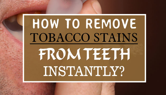 How to Remove Tobacco Stains From Teeth Instantly?
